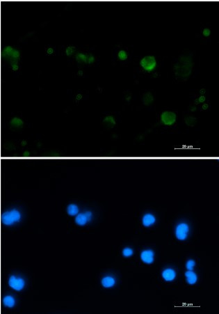 ACO2 Antibody in Immunocytochemistry (ICC/IF)