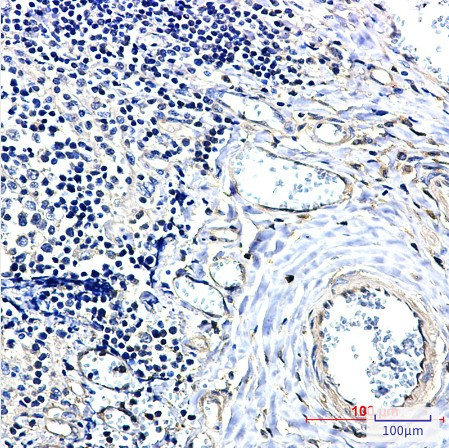 YWHAB Antibody in Immunohistochemistry (Paraffin) (IHC (P))