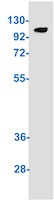 Phospho-TAOK1/TAOK2/TAOK3 (Ser181, Ser181, Ser177) Antibody in Western Blot (WB)