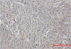 Phospho-PRKCA (Ser660) Antibody in Immunohistochemistry (Paraffin) (IHC (P))