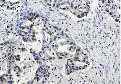 Phospho-NPM1 (Thr199) Antibody in Immunohistochemistry (Paraffin) (IHC (P))