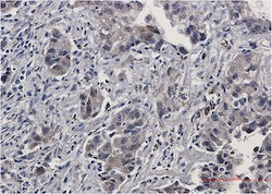 Phospho-EGFR (Tyr1173) Antibody in Immunohistochemistry (Paraffin) (IHC (P))
