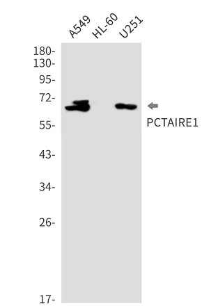 CDK16 Antibody in Western Blot (WB)