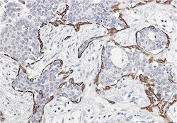 KRT17 Antibody in Immunohistochemistry (Paraffin) (IHC (P))