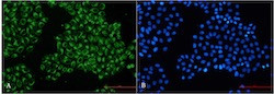 FGFR3 Antibody in Immunocytochemistry (ICC/IF)