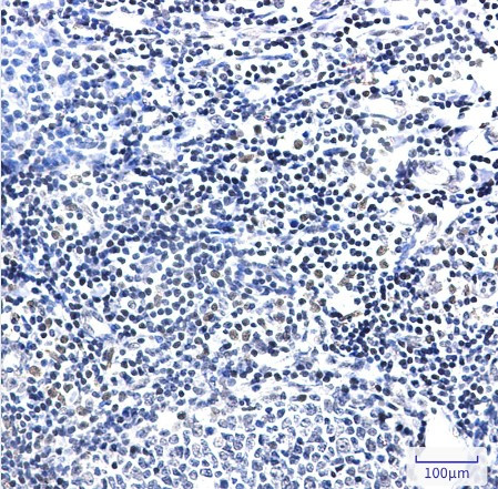PIM1 Antibody in Immunohistochemistry (Paraffin) (IHC (P))