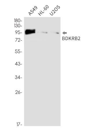BDKRB2 Antibody in Western Blot (WB)
