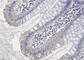 PAK1 Antibody in Immunohistochemistry (Paraffin) (IHC (P))