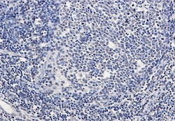 SATB1 Antibody in Immunohistochemistry (Paraffin) (IHC (P))