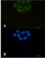 BSG Antibody in Immunocytochemistry (ICC/IF)
