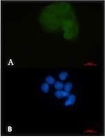 MAP2K1 Antibody in Immunocytochemistry (ICC/IF)