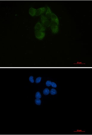 YBX1 Antibody in Immunocytochemistry (ICC/IF)