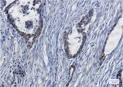 YAP1 Antibody in Immunohistochemistry (Paraffin) (IHC (P))
