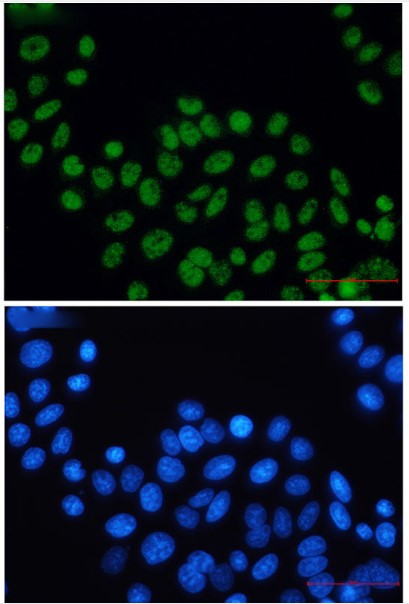 ERCC2 Antibody in Immunocytochemistry (ICC/IF)