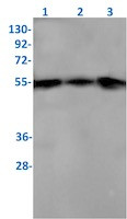 Xiap Antibody in Western Blot (WB)