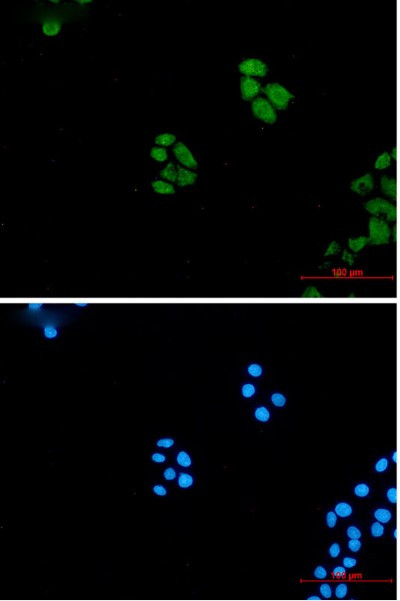 WNT5A Antibody in Immunocytochemistry (ICC/IF)
