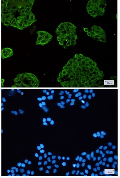 VPS4A Antibody in Immunocytochemistry (ICC/IF)