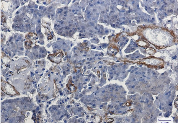 VCL Antibody in Immunohistochemistry (Paraffin) (IHC (P))