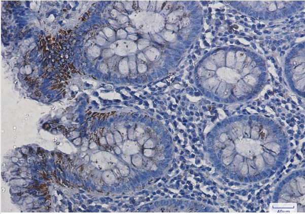 VDAC1 Antibody in Immunohistochemistry (Paraffin) (IHC (P))