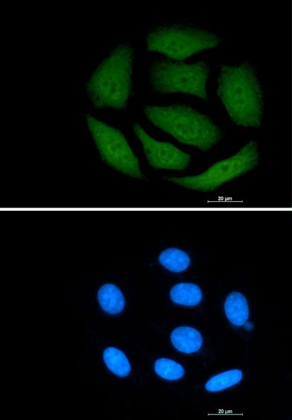 VCP Antibody in Immunocytochemistry (ICC/IF)