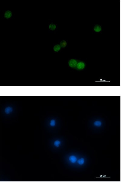 VAMP2 Antibody in Immunocytochemistry (ICC/IF)