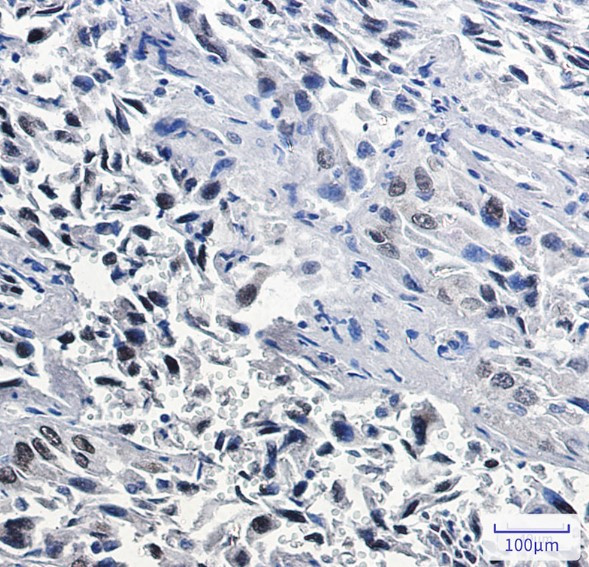 NKX2-1 Antibody in Immunohistochemistry (Paraffin) (IHC (P))
