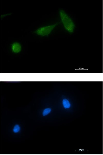 TSG101 Antibody in Immunocytochemistry (ICC/IF)