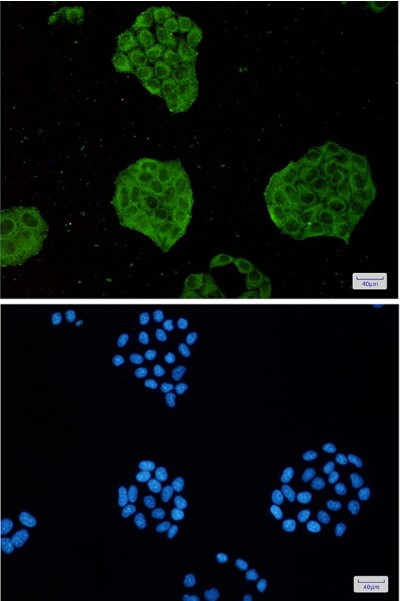 TRIM56 Antibody in Immunocytochemistry (ICC/IF)