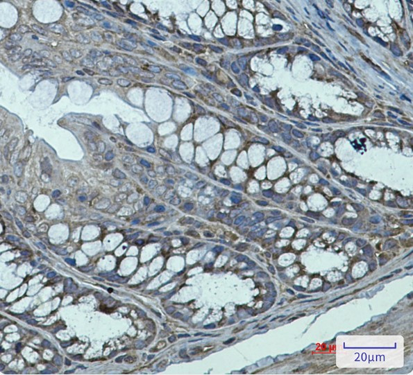 TGM2 Antibody in Immunohistochemistry (Paraffin) (IHC (P))