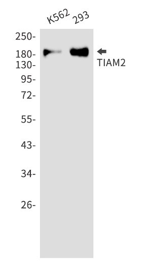 TIAM2 Antibody in Western Blot (WB)