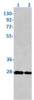 TK1 Antibody in Western Blot (WB)