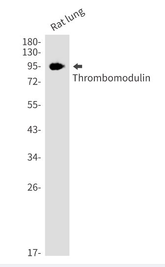 Thbd Antibody in Western Blot (WB)