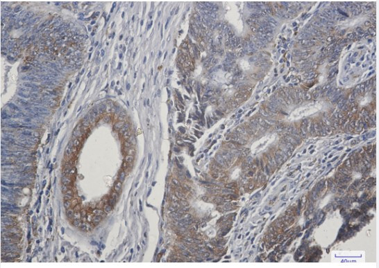 TGFA Antibody in Immunohistochemistry (Paraffin) (IHC (P))