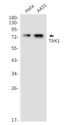 MAP3K7 Antibody in Western Blot (WB)