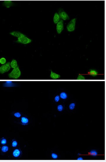BIRC5 Antibody in Immunocytochemistry (ICC/IF)