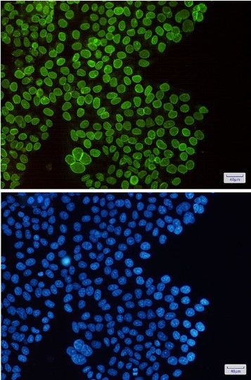 SUN1 Antibody in Immunocytochemistry (ICC/IF)