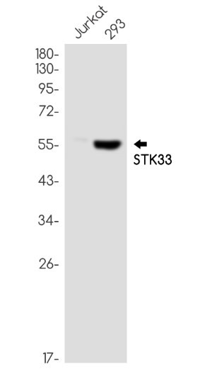 STK33 Antibody in Western Blot (WB)