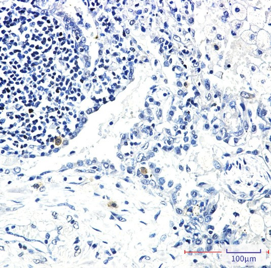 STK3 Antibody in Immunohistochemistry (Paraffin) (IHC (P))