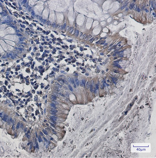 SRC Antibody in Immunohistochemistry (Paraffin) (IHC (P))