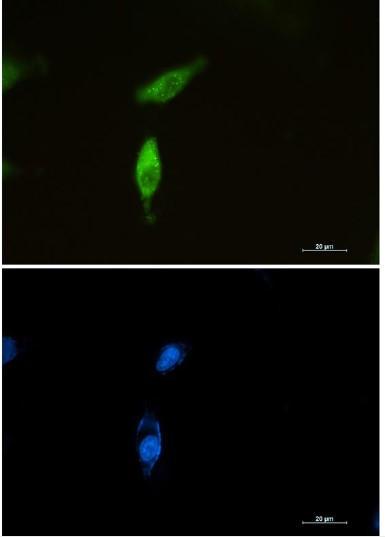 SQSTM1 Antibody in Immunocytochemistry (ICC/IF)