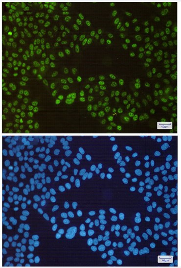 SP1 Antibody in Immunocytochemistry (ICC/IF)