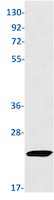 SOCS2 Antibody in Western Blot (WB)