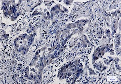 SMAD5 Antibody in Immunohistochemistry (Paraffin) (IHC (P))