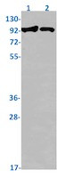 SLCO5A1 Antibody in Western Blot (WB)