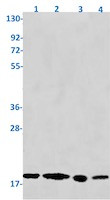 SKP1 Antibody in Western Blot (WB)