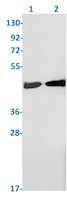 SET Antibody in Western Blot (WB)