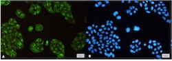 SCD Antibody in Immunocytochemistry (ICC/IF)