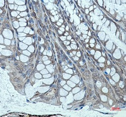 ACTN2 Antibody in Immunohistochemistry (Paraffin) (IHC (P))