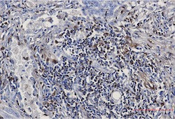 S100A4 Antibody in Immunohistochemistry (Paraffin) (IHC (P))
