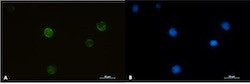 RRM2 Antibody in Immunocytochemistry (ICC/IF)